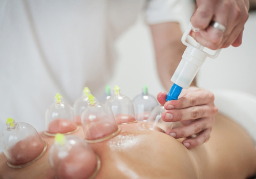 hijama therapy treatment in palam